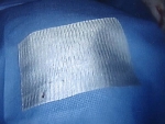 This adhesion barrier looks and feels like a silky piece of gauze.